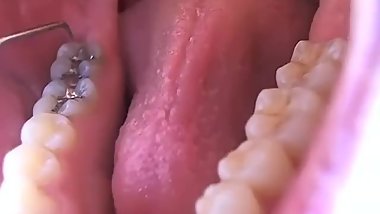 mouth teeth fetish 4